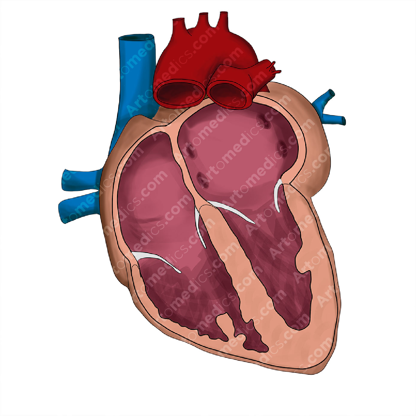 left-atrial-enlargement-anterior-view-artomedics-studio